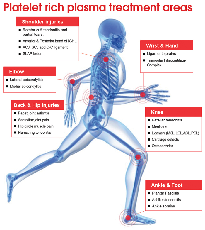 prp injection / therapy Feet pain